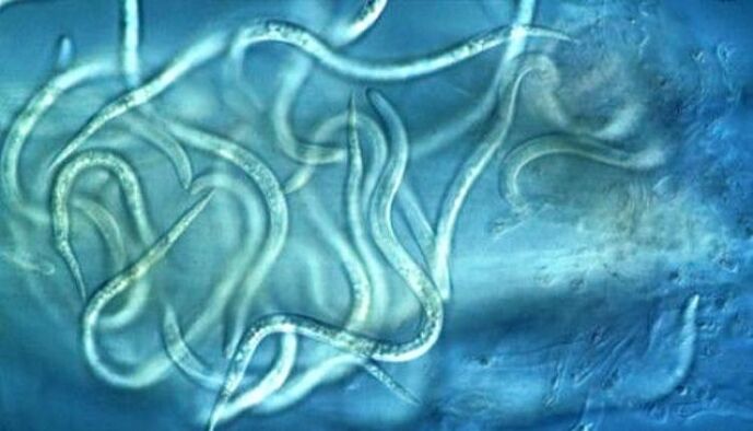 What a nematode parasite looks like in the human body