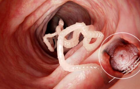 Worm is a parasite in the human body