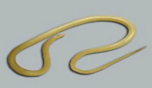 roundworms from the human body